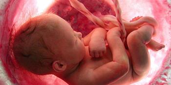مستند زندگی پیش از تولد (غربالگری سه ماهه اول بارداری)